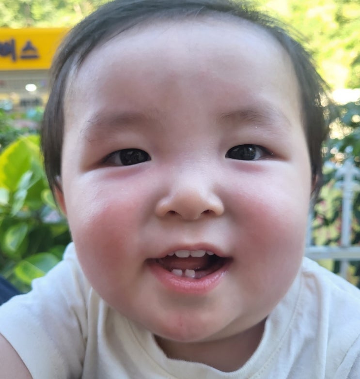  아기이 앓이 증상 시기 대처법