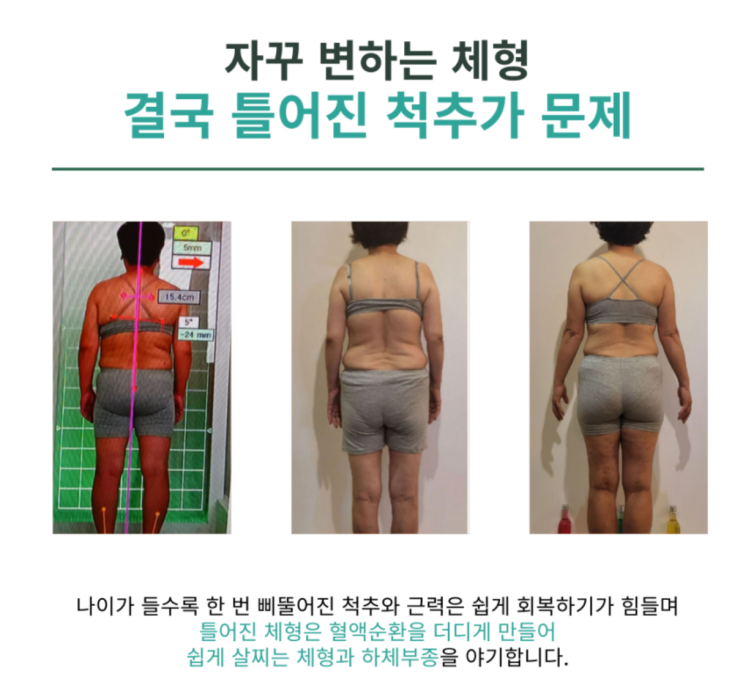  40대 빠지지 않는 나잇살, 슬리밍고 24다이어트 프로그램으로 근본적인 문제 해결부터