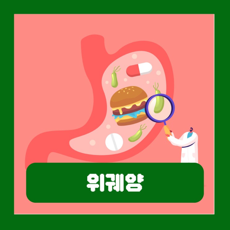  위궤양 초기증상 원인 좋은 음식 조직검사 위암 발전 가능성