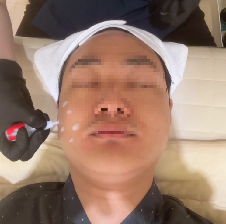  압구정 피부관리 마이크로MTS 멈춤에스테틱