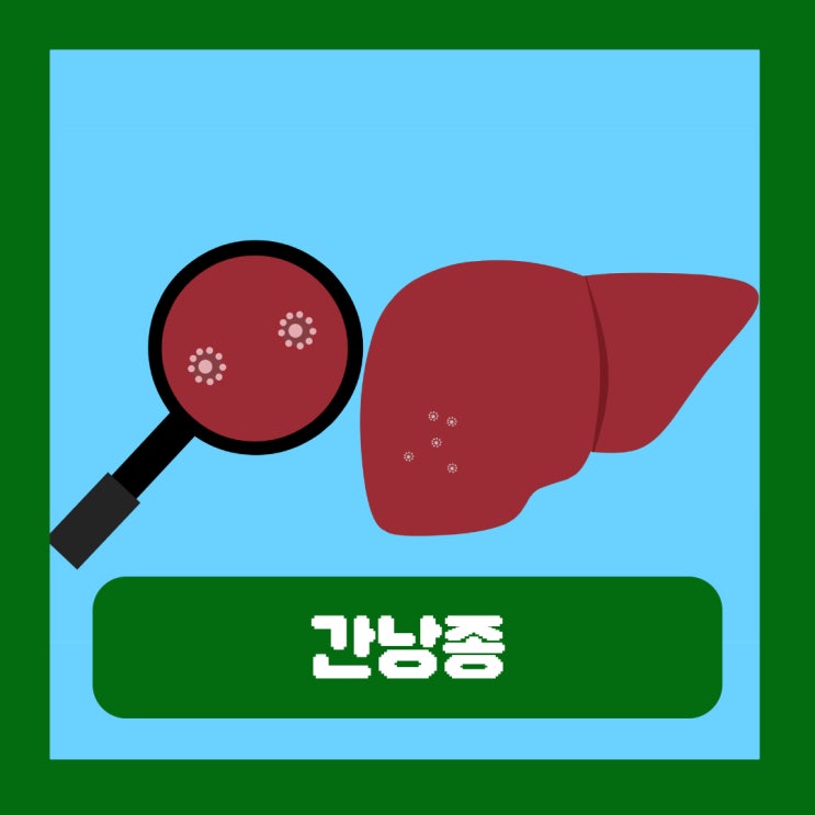  간에 물혹 생기는 이유 간낭종 원인 없애는 방법 초음파 크기