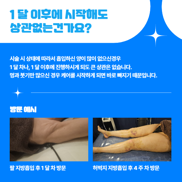 지방흡입 관리 3 개월 안에 최대한 회복하는 방법 알려드릴게요.