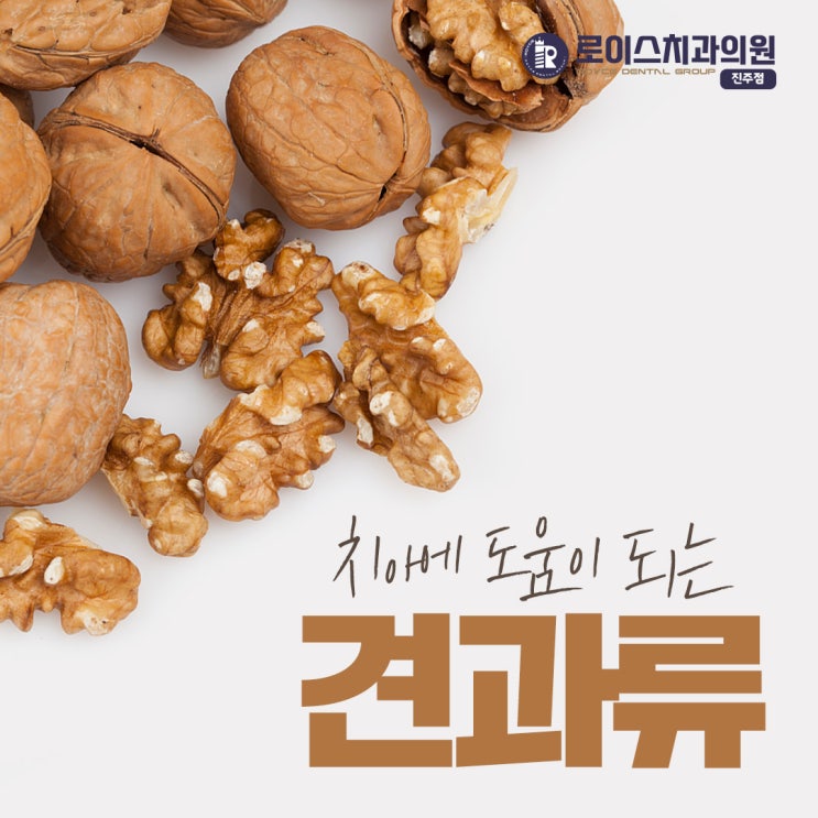  진주로이스치과 "치아 건강을 지키는 음식과 피해야 할 음식, 알고 먹자"