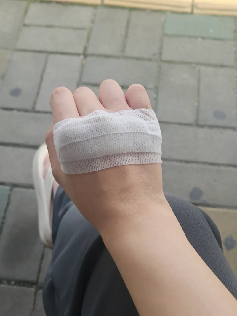 광주 화상 전문 병원 추천 시원외과 후기