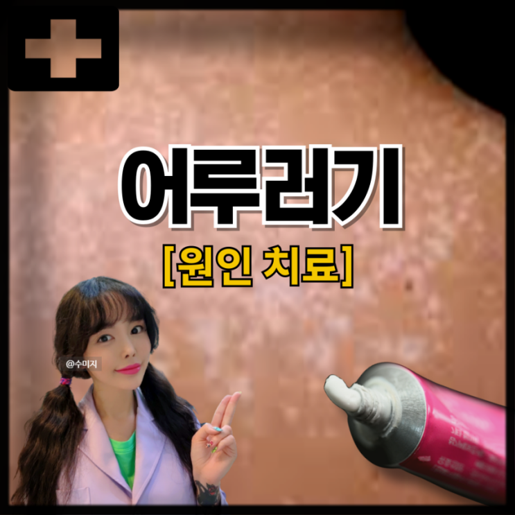  어루러기 전염 증상 원인 치료 피부 갈색반점 곰팡이균 연고 어우러기 겨드랑이 어루러기
