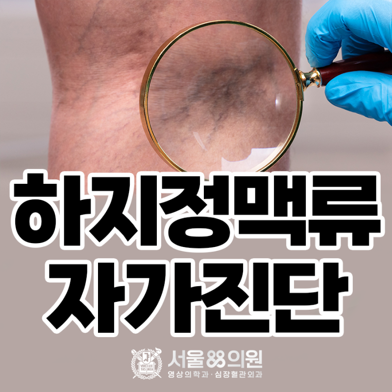 [수원 하지정맥류병원, 서울88의원] 하지정맥류 자가진단
