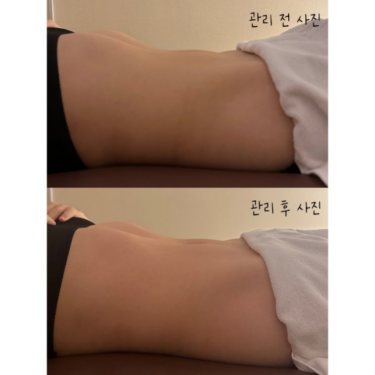  홀리스떼의정부점 블리의팔레트 마르지아 클리닉 후기