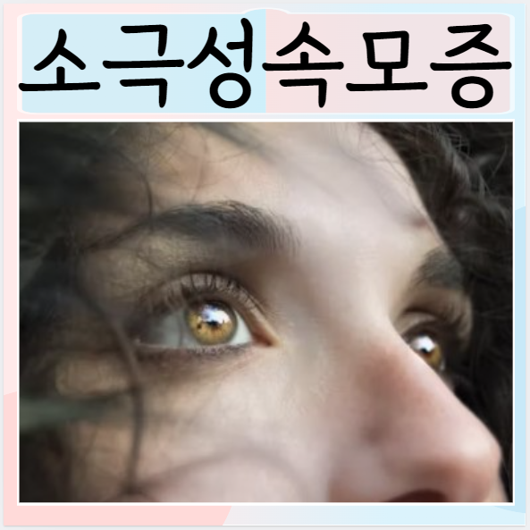  소극성속모증 원인 치료방법