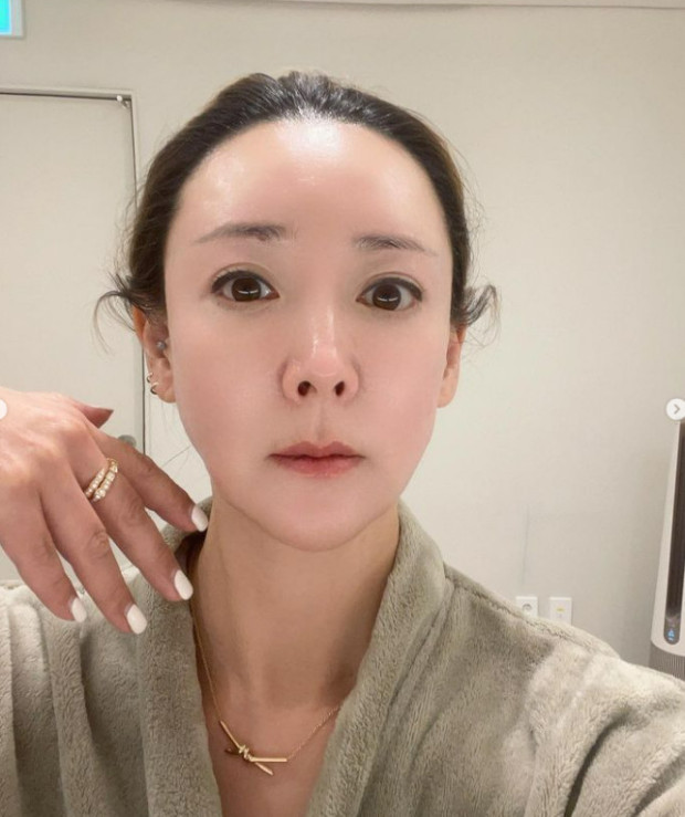 이상아 3번 이혼 관상 성형 이유 콧구멍 박원숙의 같이삽시다 이상아 3번 이혼 관상 성형 이유 콧구멍 박원숙의 같이삽시다