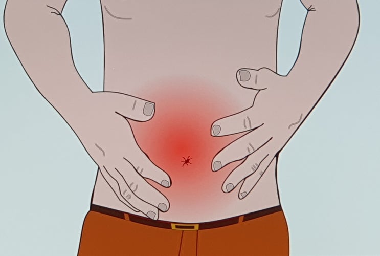 장누수증후군 증상 뭘까? 검사 치료 및 장이 안좋을때 또는 아플때