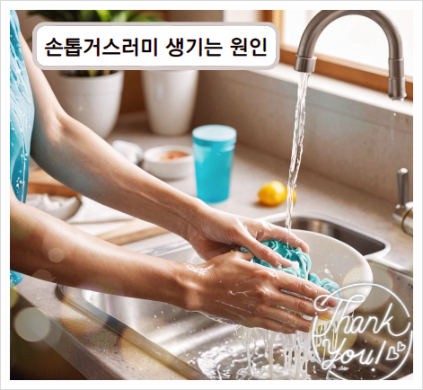 손톱거스러미 손톱가시래기 해결