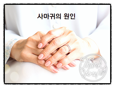  손등사마귀 편평사마귀 자연치유 되나