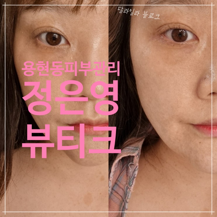  용현동 피부관리 추천 정은영뷰티크에서 하이푸와 물방울소노 관리 후기