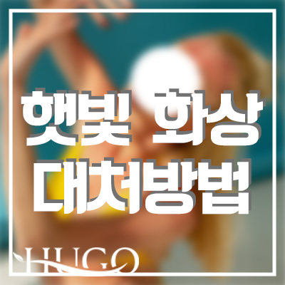 햇빛 화상 대처방법은