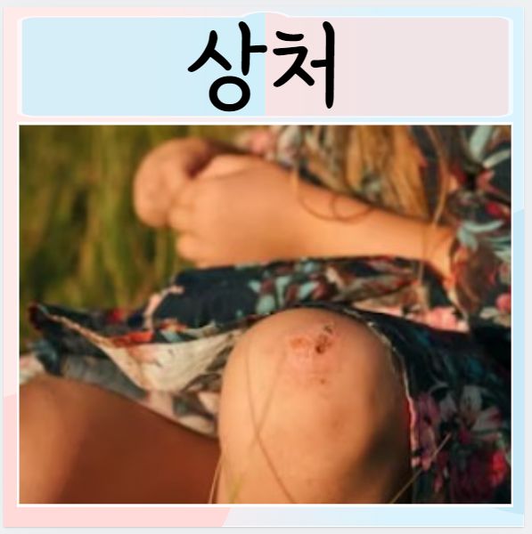  상처간지러움 원인 간지러울때 주의사항 상처딱지