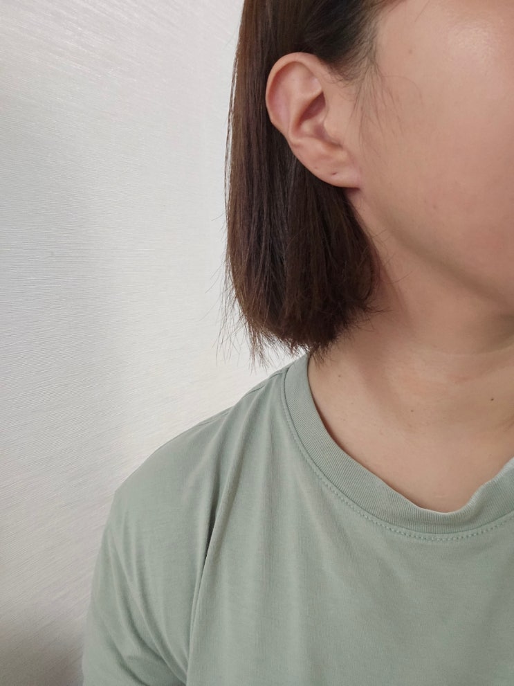 침샘암 방사선치료 후 섬유화 피부  도수치료