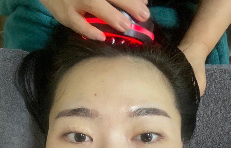  대구 윤곽관리 미본가 후기 (가격, 시술 전과정, 전후 비교사진)