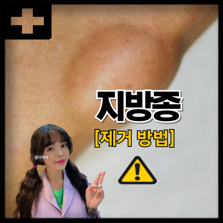  피부 양성종양 지방종 원인, 겨드랑이 얼굴 목뒤 등 지방종 제거