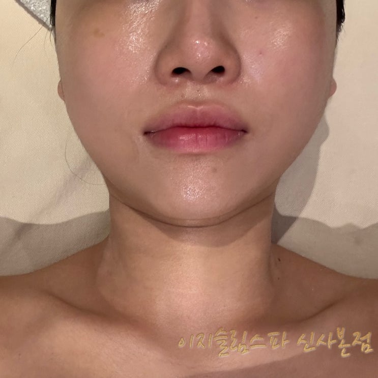  신사 피부관리 이지슬림스파 신사본점 고경미 성형케어로 얼굴 라인 개선함