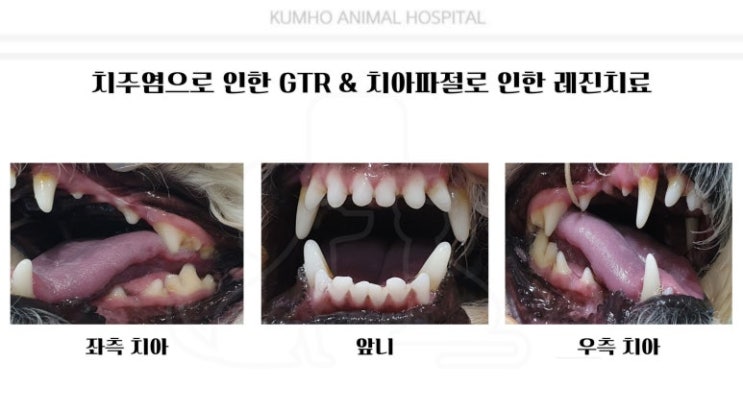  광주 강아지 치과 - 6살 강아지의 치주염으로 인한 치주조직재생술 & 치아 파절로 인한 레진 치료 Case [광주 치과 동물병원, 금호동 동물병원, 강아지 신경치료]