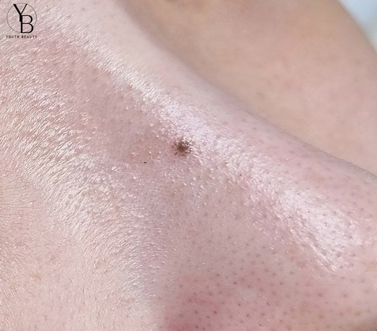  광주 미인점 차원이 다른 유스뷰티