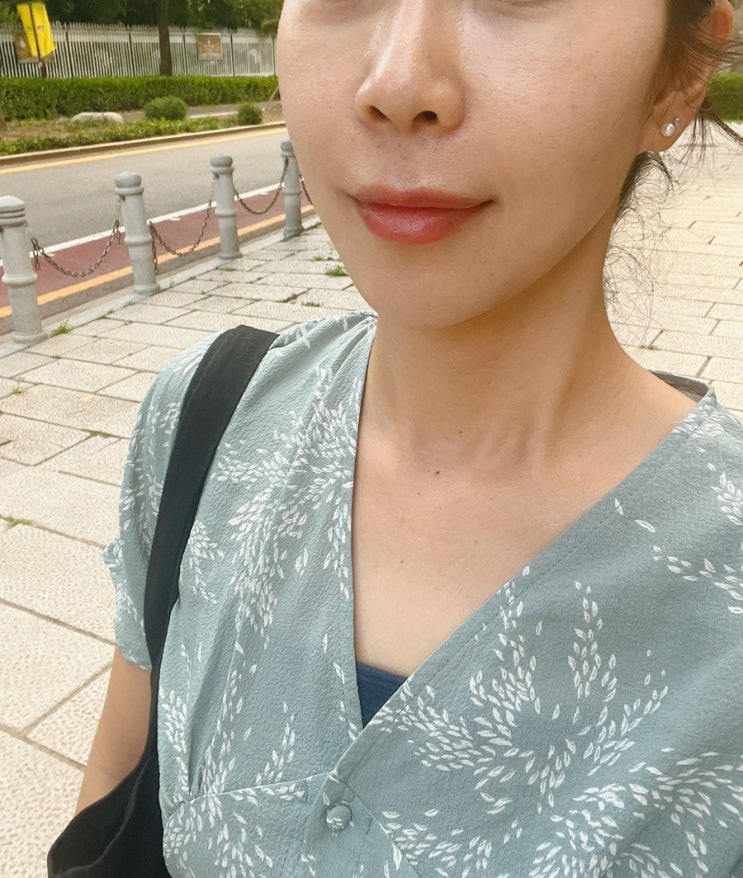  울쎄라 400샷 한달 차 리얼후기 | 울쎄라 통증 붓기 가격