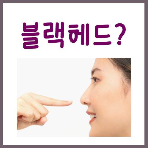  블랙헤드 생기는 이유? '이걸' 몰라서 더 악화되는 겁니다