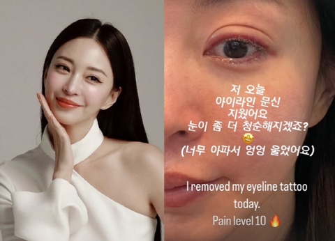 <b>한예슬</b>, "고통레벨 10, <b>아이라인 문신</b> 제거 실시간 공개 "더... 