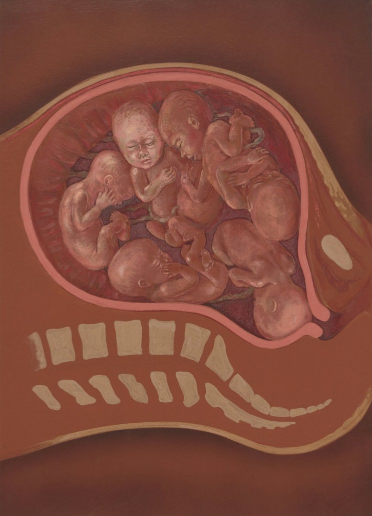  자궁경부