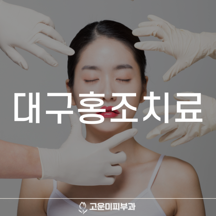  대구홍조치료 얼굴이 붉어지고 화끈거리는 안면 홍조 방치하면 주사 피부염이 생길 수 있어요