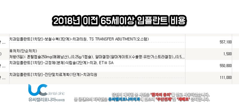 임플란트 비용지원 혜택을 확인해보세요 2
