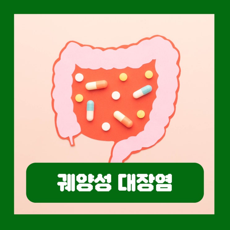  궤양성 대장염 혈변 증상 원인 치료 완치 가능성 식단 군대