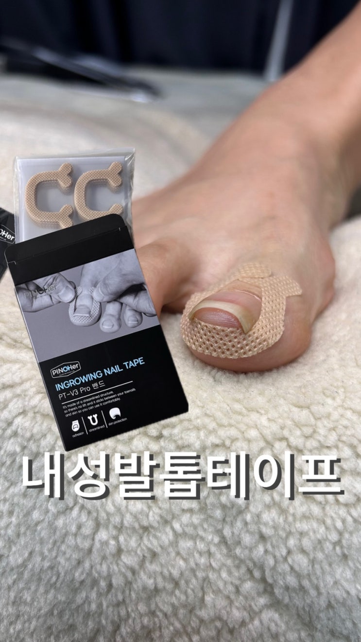  내성발톱테이프 발톱관리 도움주는 핀처 프로밴드 솔직 사용후기