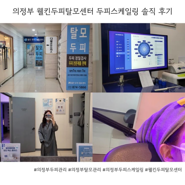  의정부 웰킨두피탈모센터 두피스케일링 솔직 후기