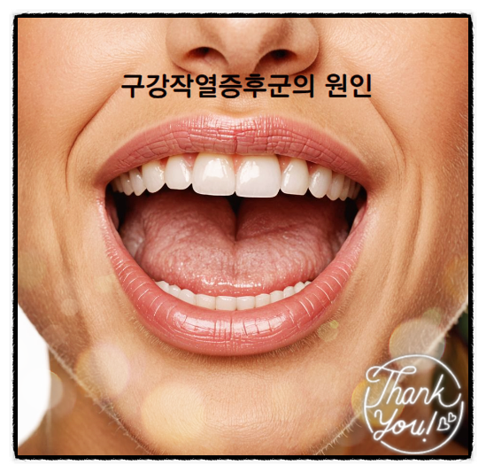  구강작열감증후군이 뭔가요