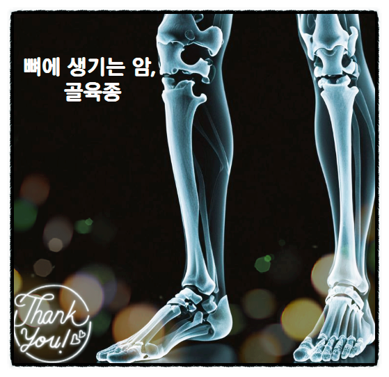  골육종 증상 뼈에도 암이?