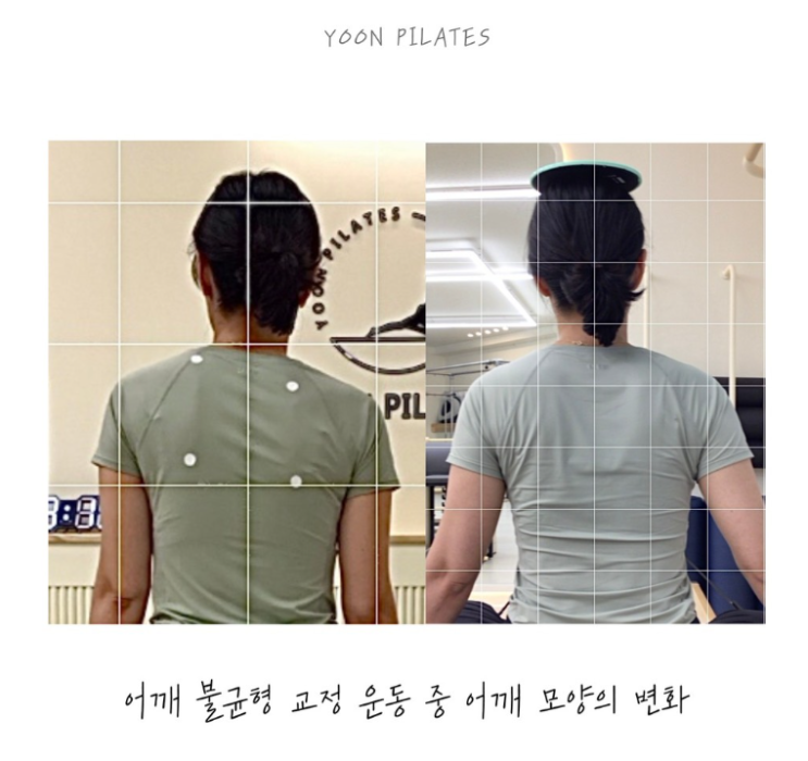  [춘천필라테스]정확한 체형분석과 재활운동