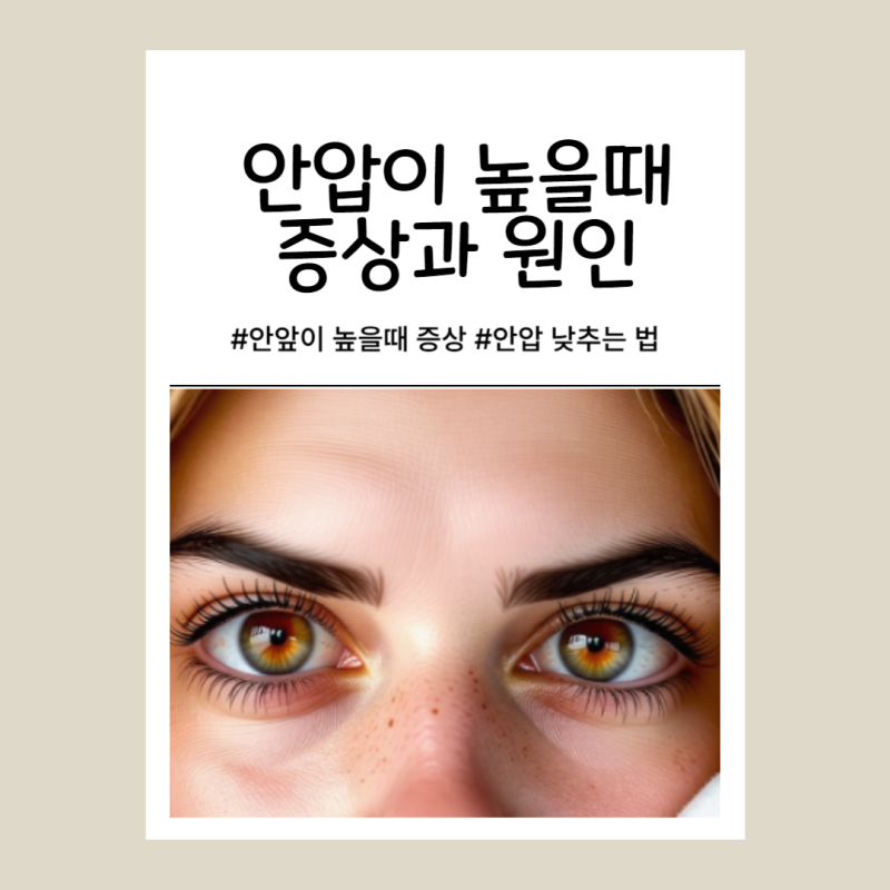 안압 높을때 증상과 원인 낮추는 방법