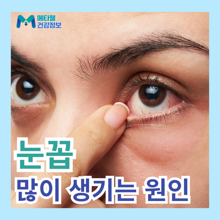 갑자기 눈꼽 많이 생기는 이유,  자주 눈곱 끼는 증상 원인은?
