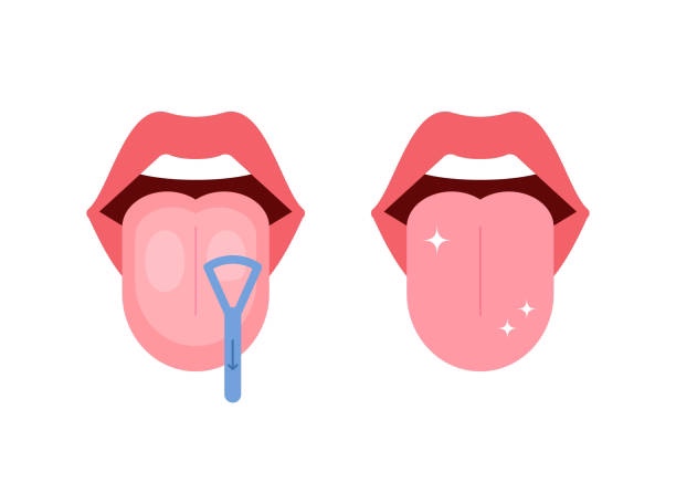  혀로 보는 건강 상식,, 백태, 혀갈라짐, 입마름