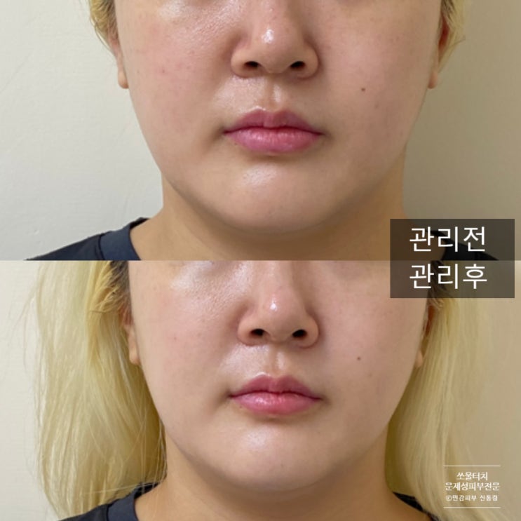  부천중동피부관리 윤곽관리 효과 실체