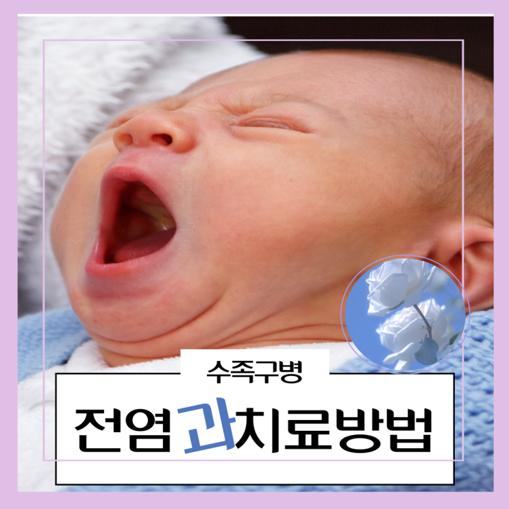  여름질병 수족구병 전염 성인도 걸릴 수 있을까?