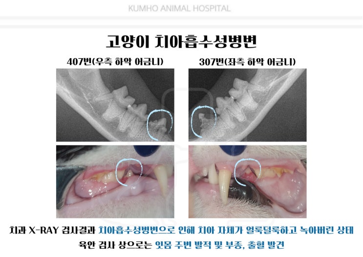  광주 고양이 치과 -6살 고양이의 치아흡수성병변으로 인한 발치 Case [광주 치과 동물병원, 금호동 동물병원, 고양이 치아흡수, 고양이 발치]