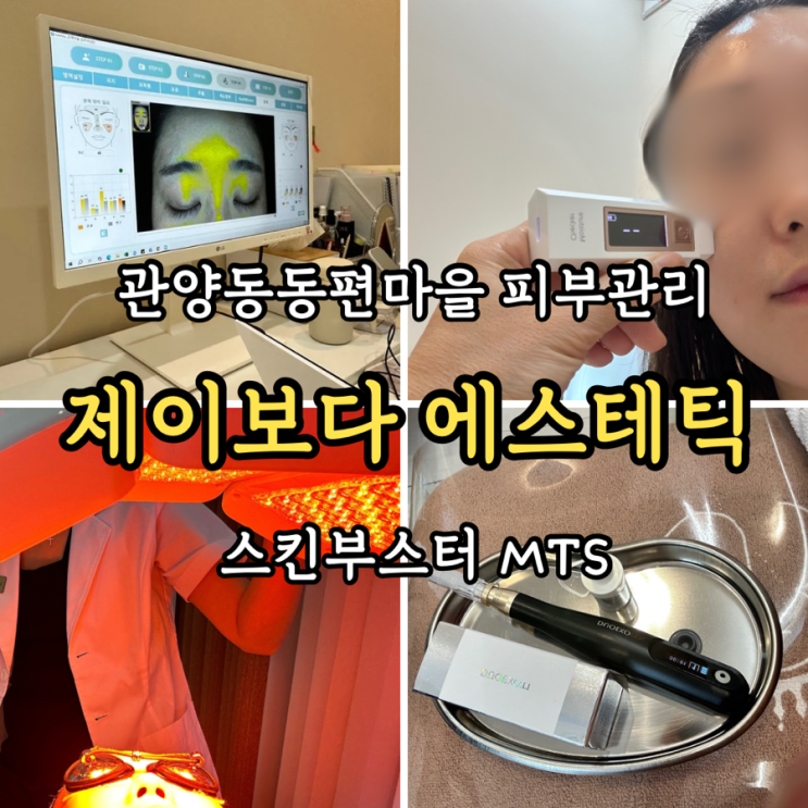  [안양/관양동피부관리] 동편마을 제이보다에스테틱 스킨부스터 MTS 관리 후기