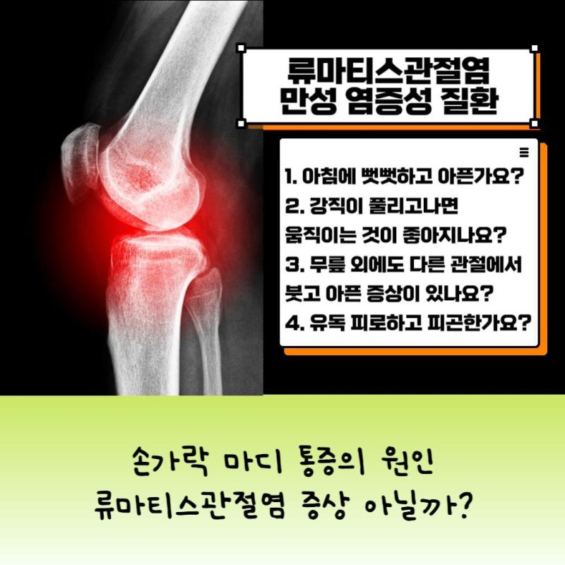 대전에서 류마티스내과 전문의 찾으신다면? 대전 류마내과로 오세요! [대전 류마티스내과]