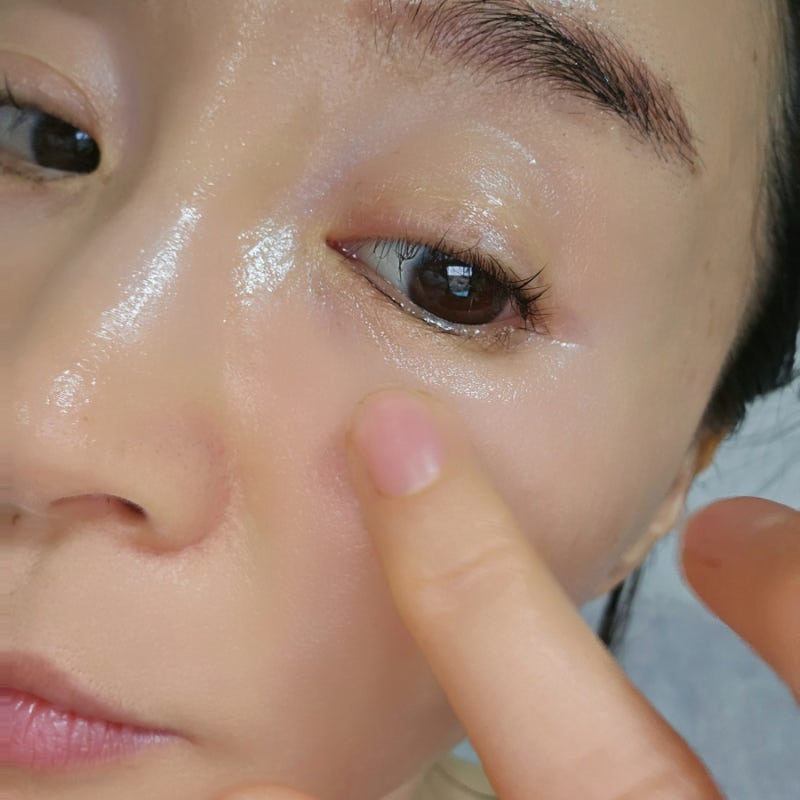변정수 눈밑지방 제거 닥터멜락신아이팔트 아이백 크림 내돈내산 솔직 리뷰