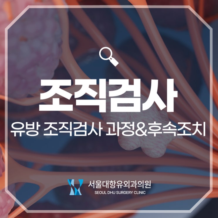  유방 조직검사 방법과 후속 조치는