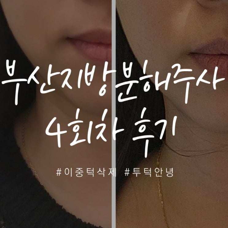  부산 지방분해주사 리포사 4회차 후기 (이중턱 턱살 뱃살 주사 비포 에프터 확실!)