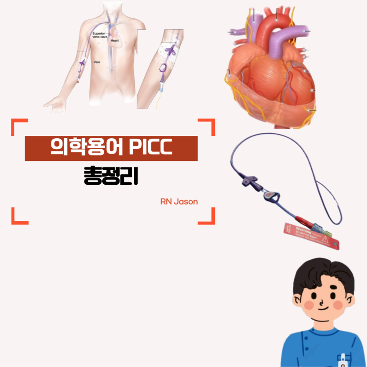  의학용어 PICC의 full term과 적용증 그리고 부작용 총정리!