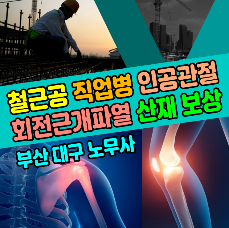  [직업병 산재 보상] 철근공 어깨 회전근개파열 / 무릎 인공관절 수술